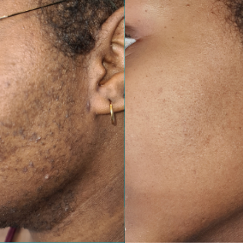 Nadia K., 34 Jahre – Zürich