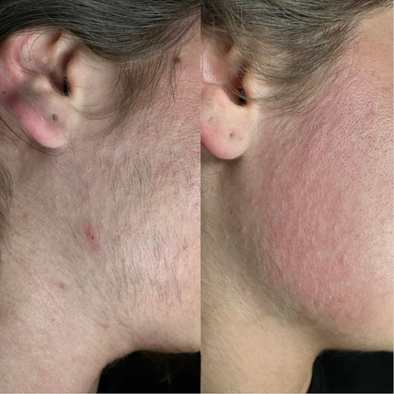 Laura D., 41 Jahre – Neuenburg